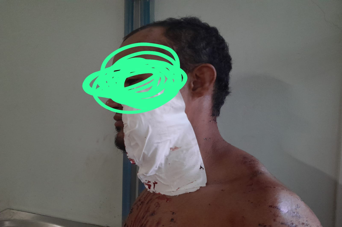 Segundo a vítima a briga começou por ciúmes da parte dela